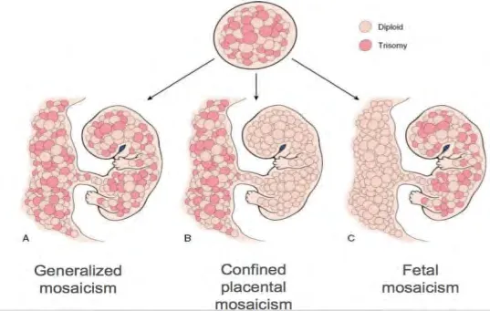Fetal Mosaicism